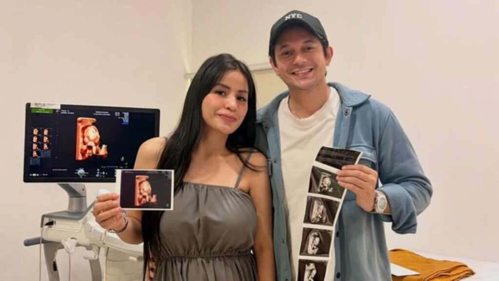 Andrew Andika Bahagia Bukan Main, Anak Perempuan dari Violentina Kaif Segera Lahir!